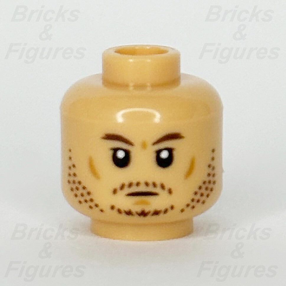 epi