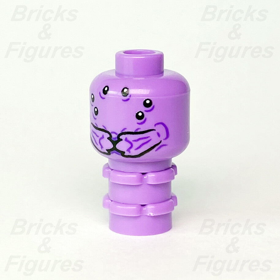 epi