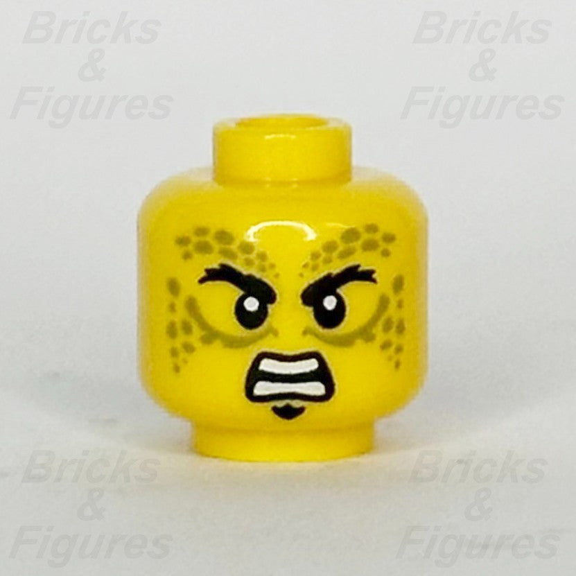 epi