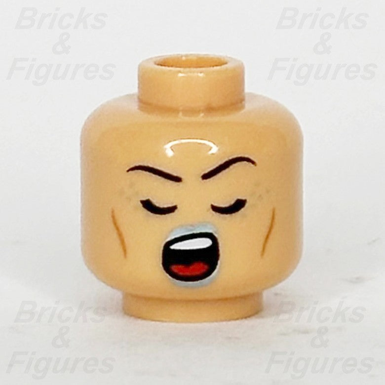 epi