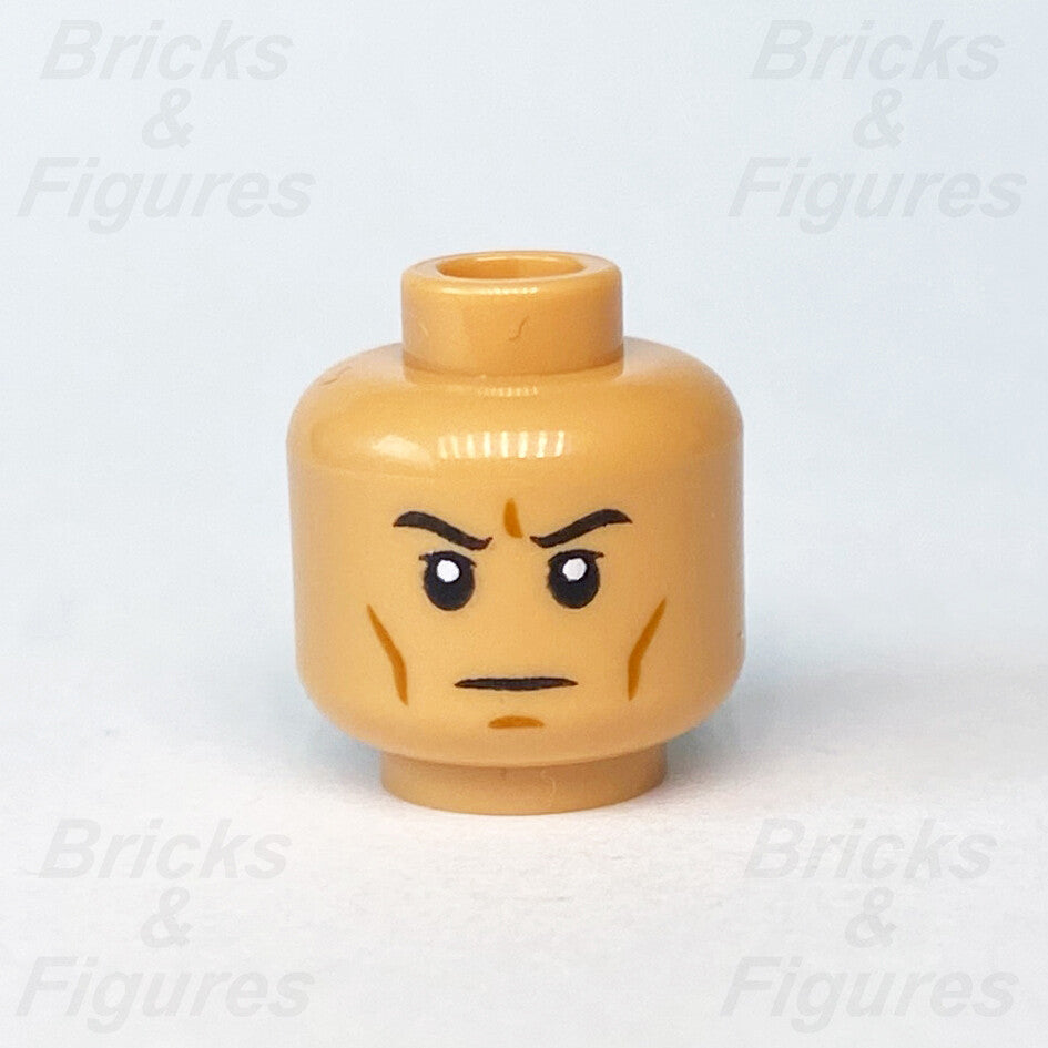 epi
